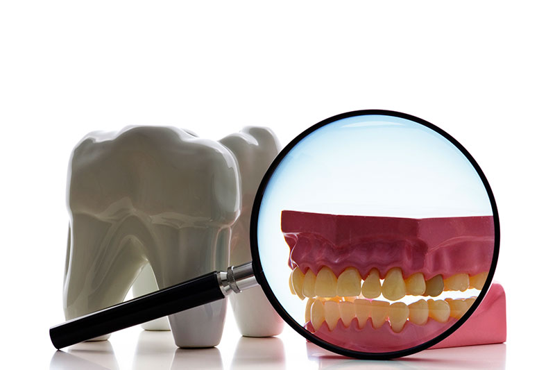 Root Canal in London